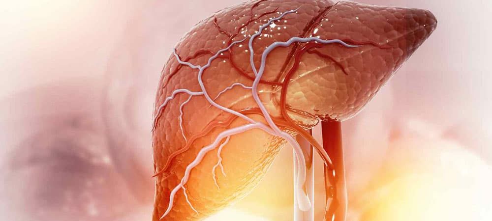 alcohol-associated liver disease