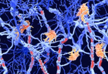 کارشناسان امیدوارند این نتایج به پزشکان کمک کند تا بفهمند کدام بیماران در معرض خطر بیشتر عوارض هستند. عکس از (Juan Gaertner)/ (Science Photo Library RF)